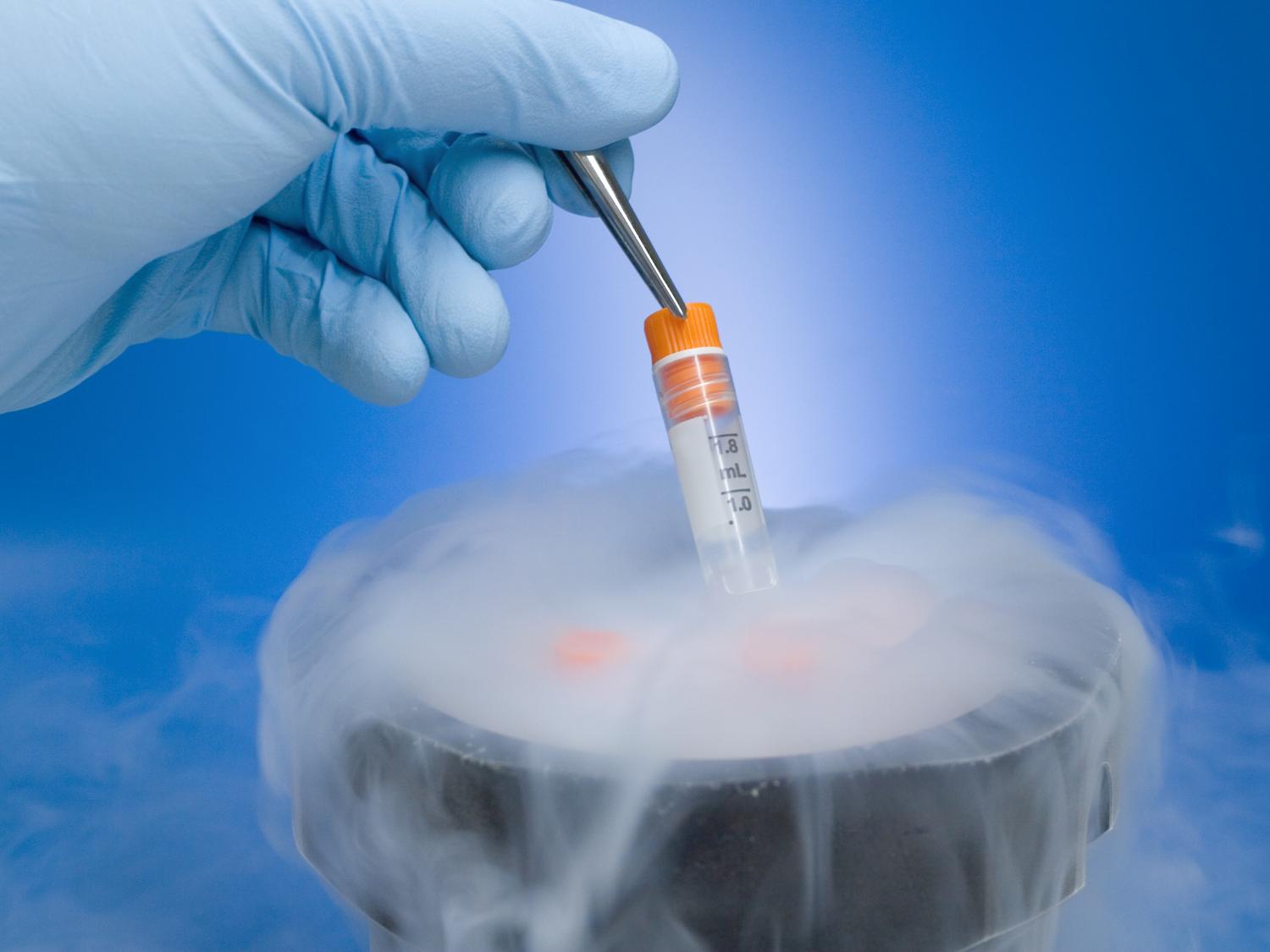 cryopreservation