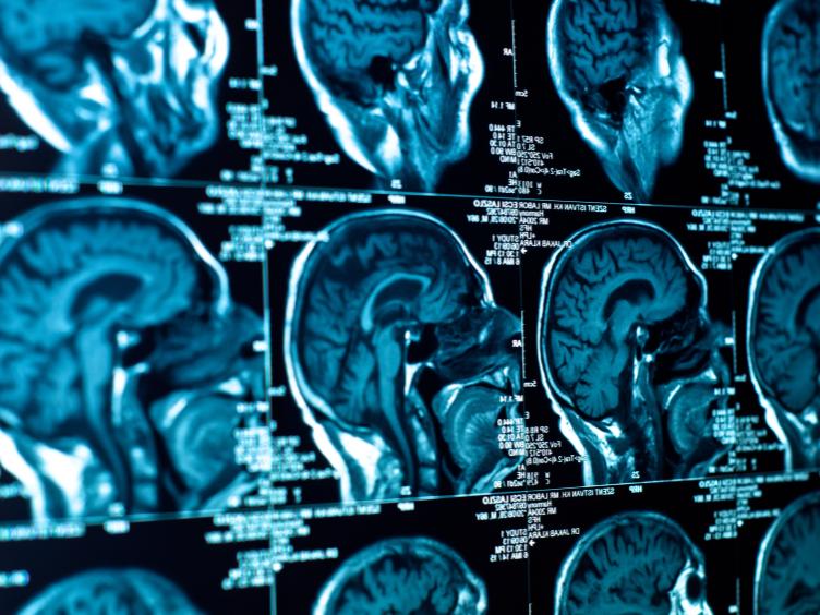 Closeup of a CT scan with human brain