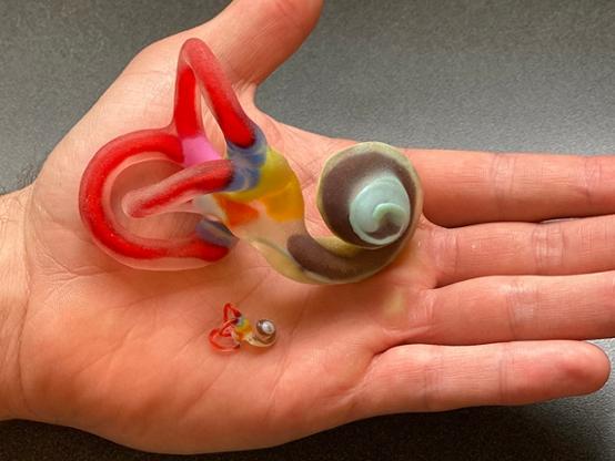 A life-size and an enlarged 3D-printed model of the Bast valve.