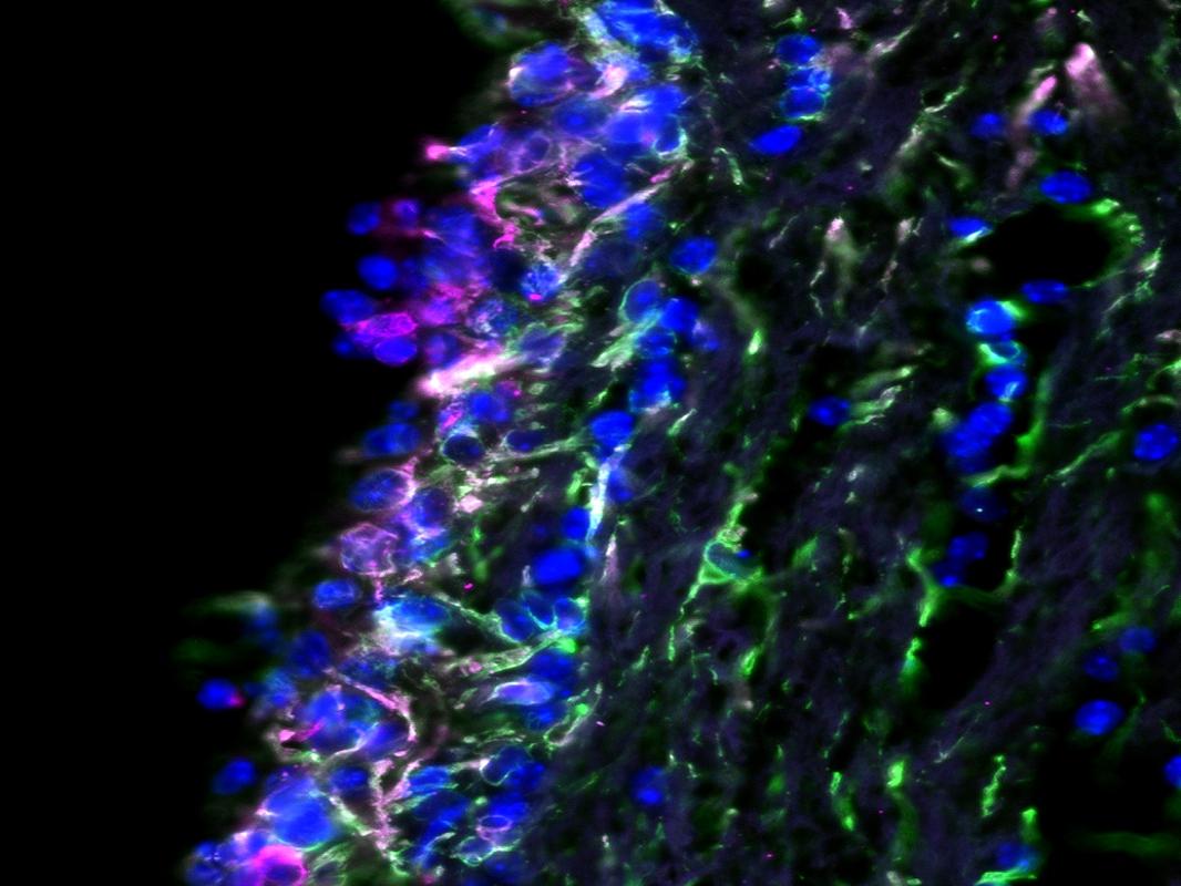 A microscopic image of a tissue section of the barrier between spinal fluid and brain. 
