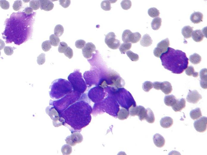 small cell lung cancer
