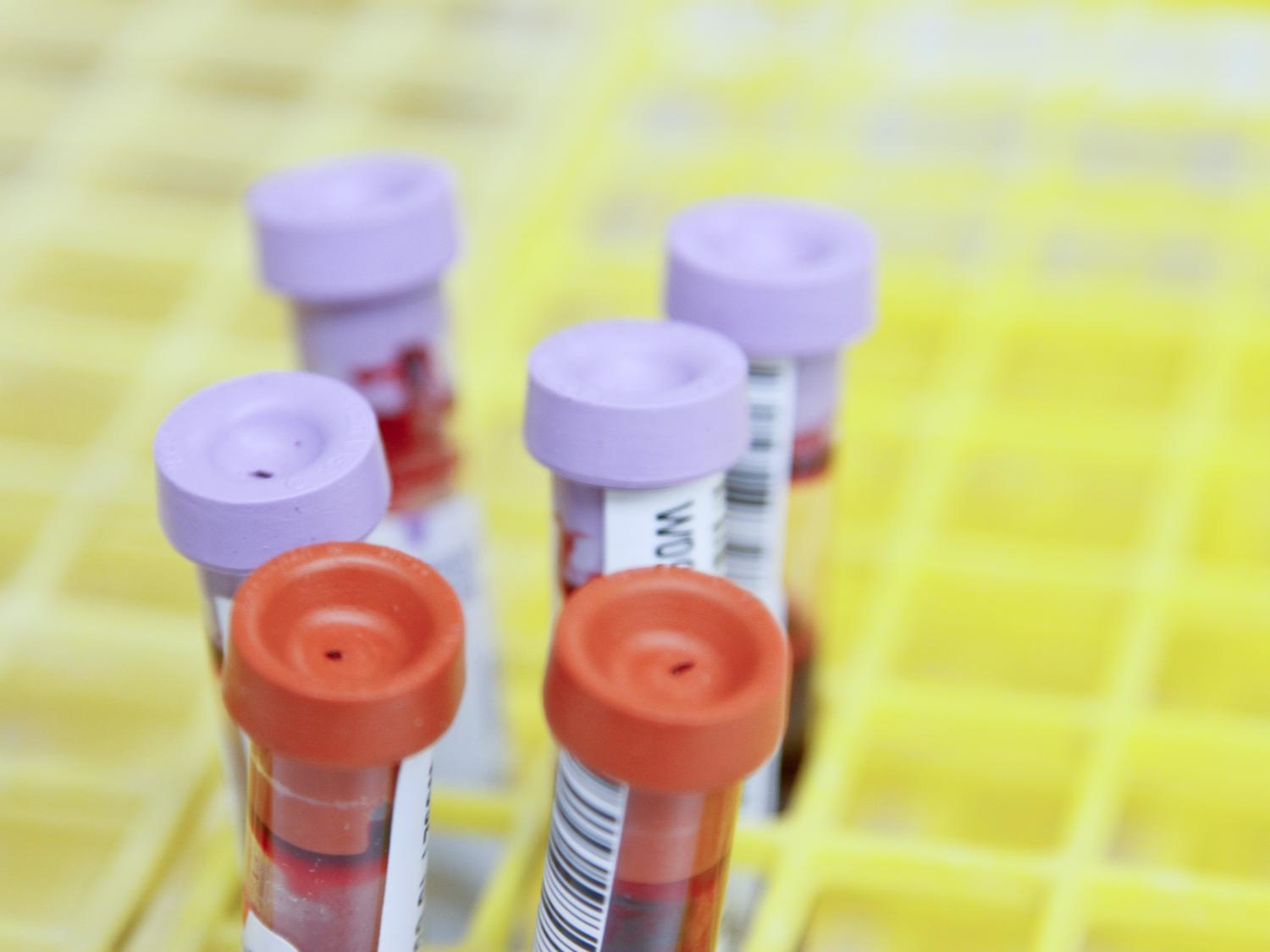 Vials of blood samples