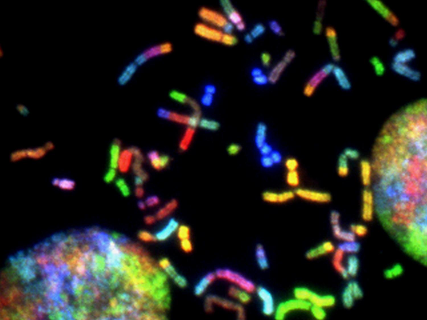 Chromosome network in cancers