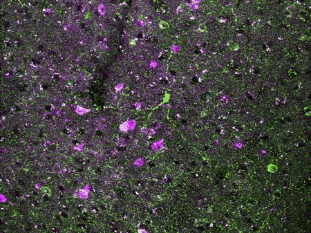 spots of pink and green show 2 different types of neurons