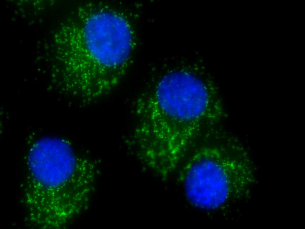 Fluorescent images of ovarian cancer cells 