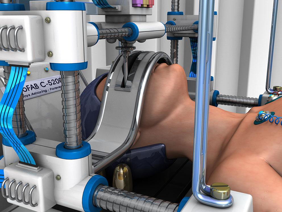 In-situ bioprinting for craniofacial reconstruction, where a human is under a bioprinter.