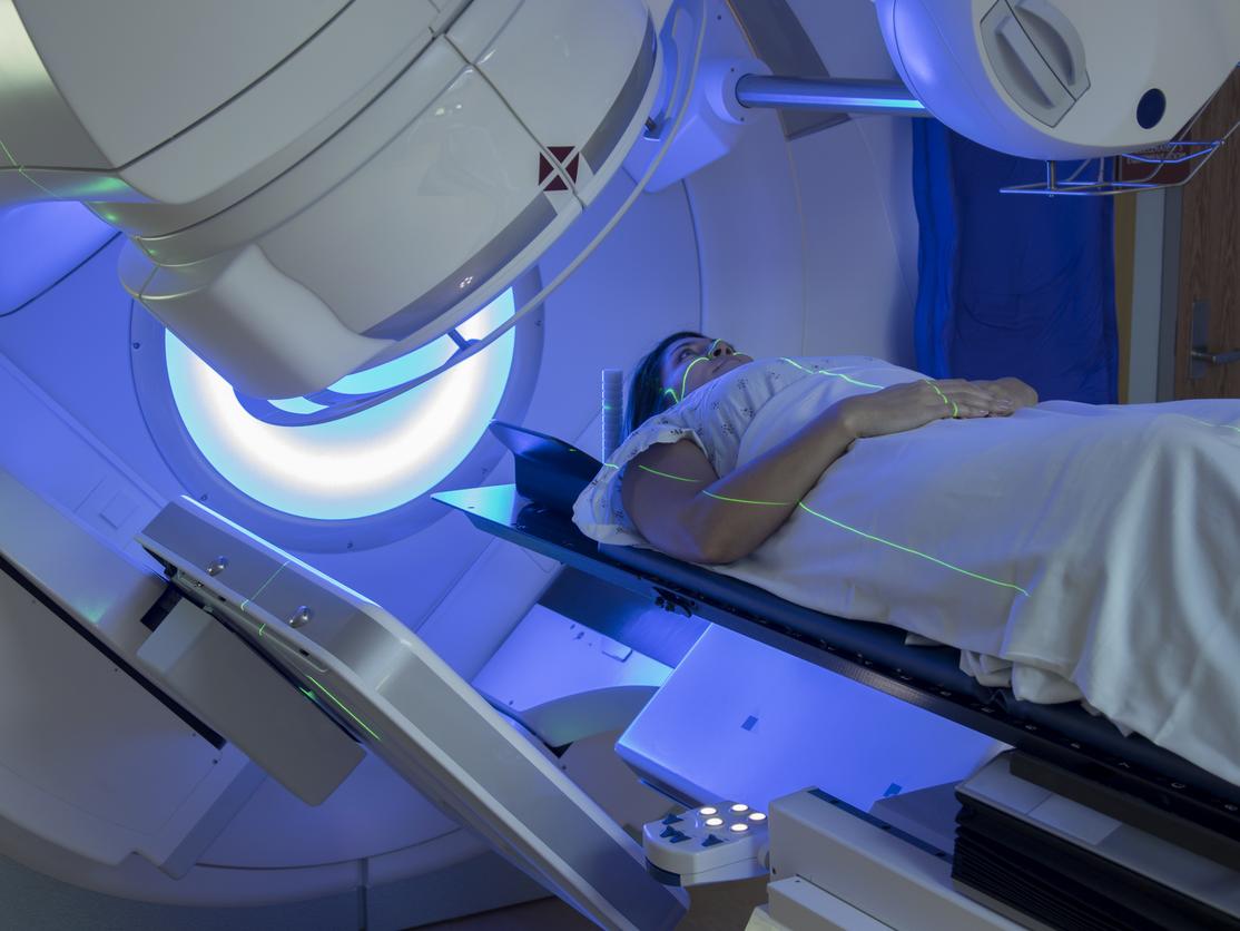 radiation therapy