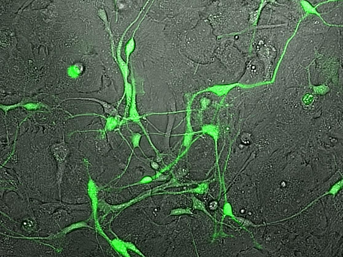 green neurons in astrocyte culture