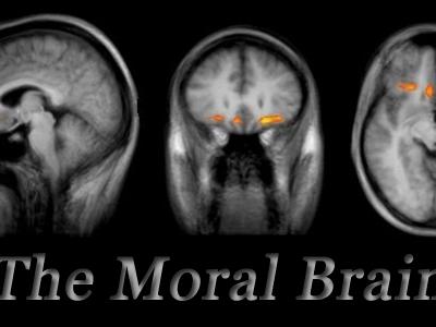 Brain Scans