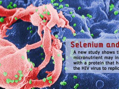 HIV-1 budding from a cultured lymphocyte