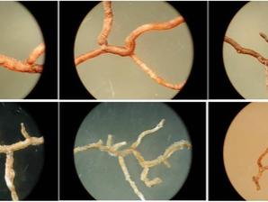 absorptive roots from various tree species