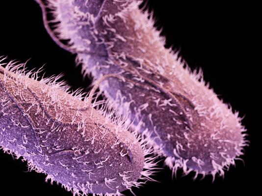 electron microscope photo salmonella