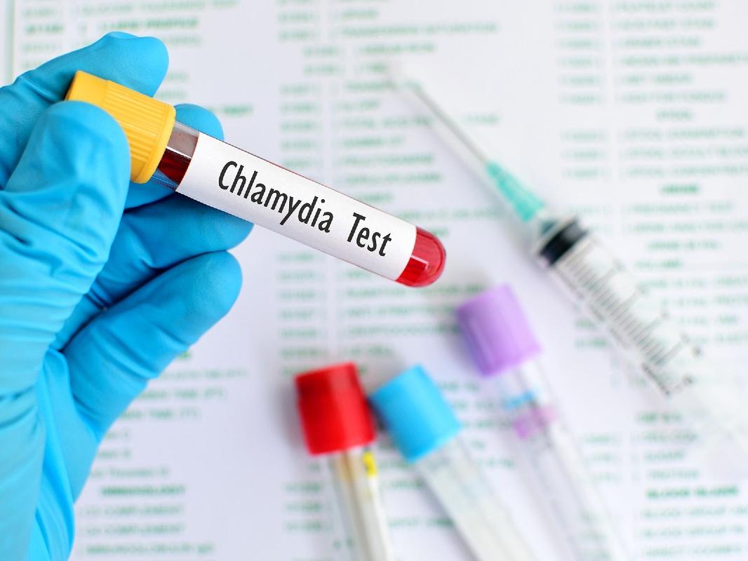 A gloved hand holds a test tube filled with blood that is labeled ‘Chlamydia Test.’