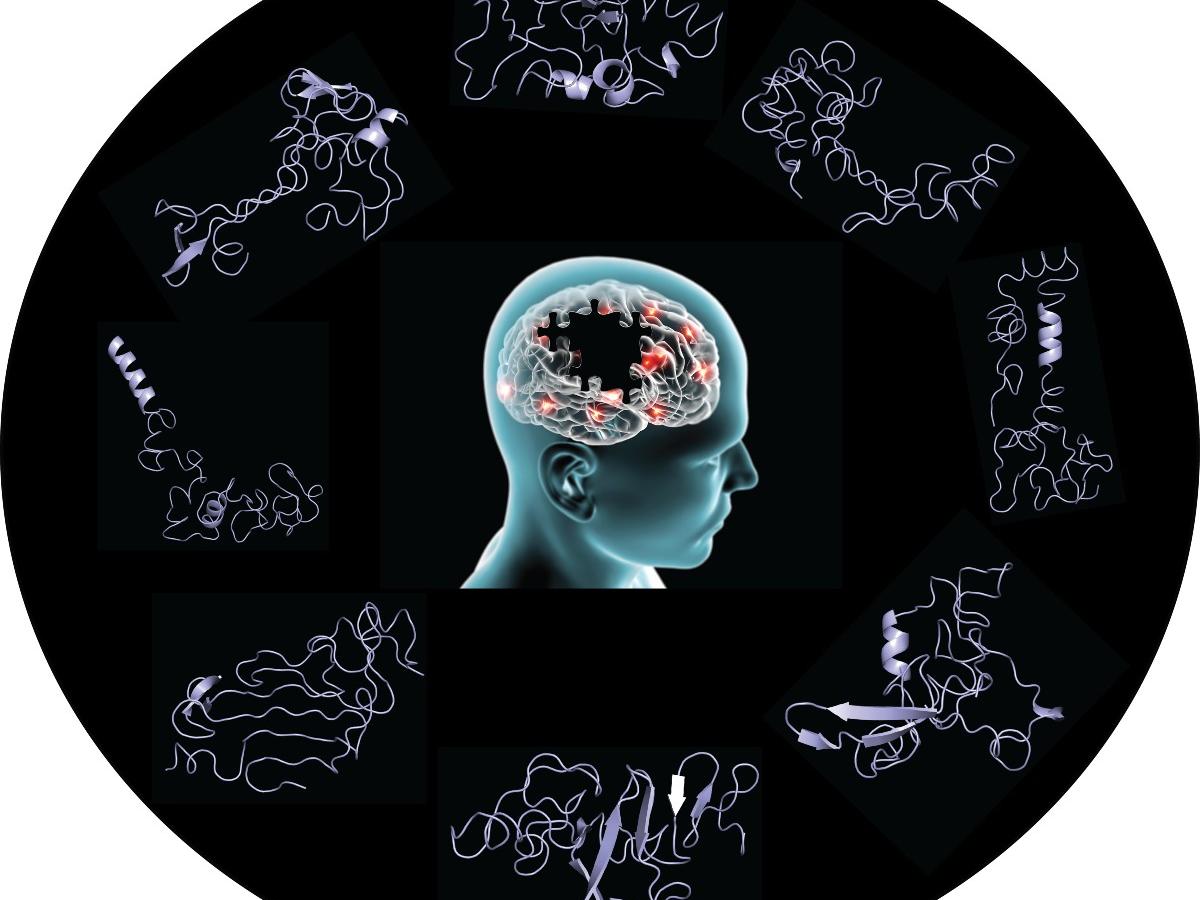 Images of various conformations of a protein called alpha-synuclein surround a human brain. 