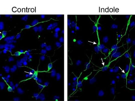 Two side-by-side photos of microscopic nerve cell representations in blue, green and black. 