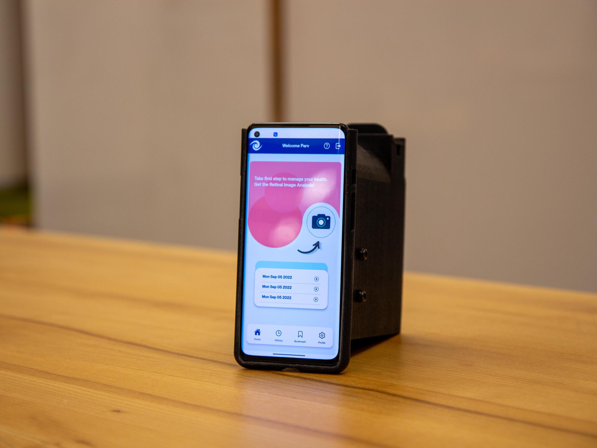 iLenz app and 3D printed prototype
