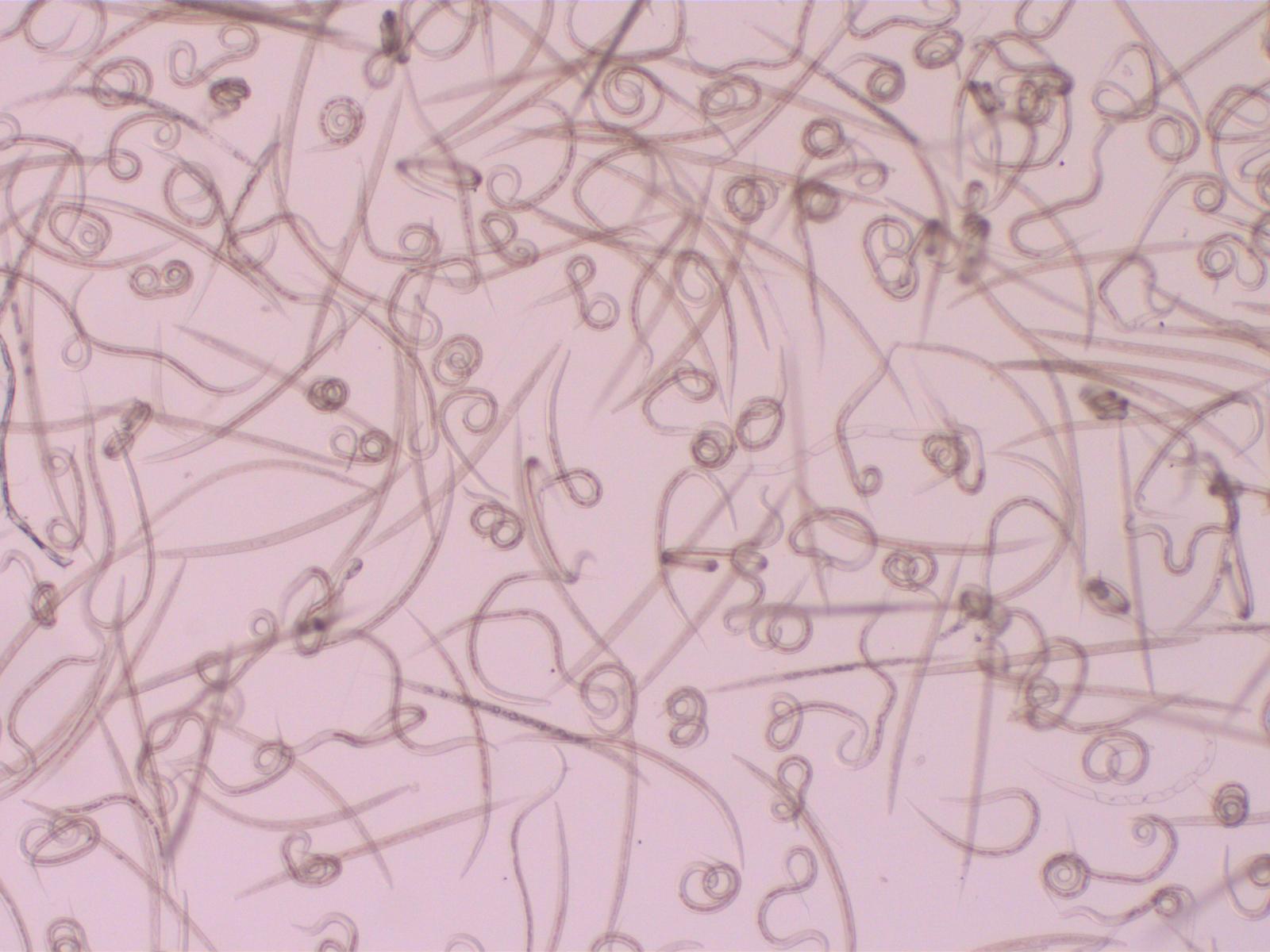 Gastrointestinal worms, image through a microscope