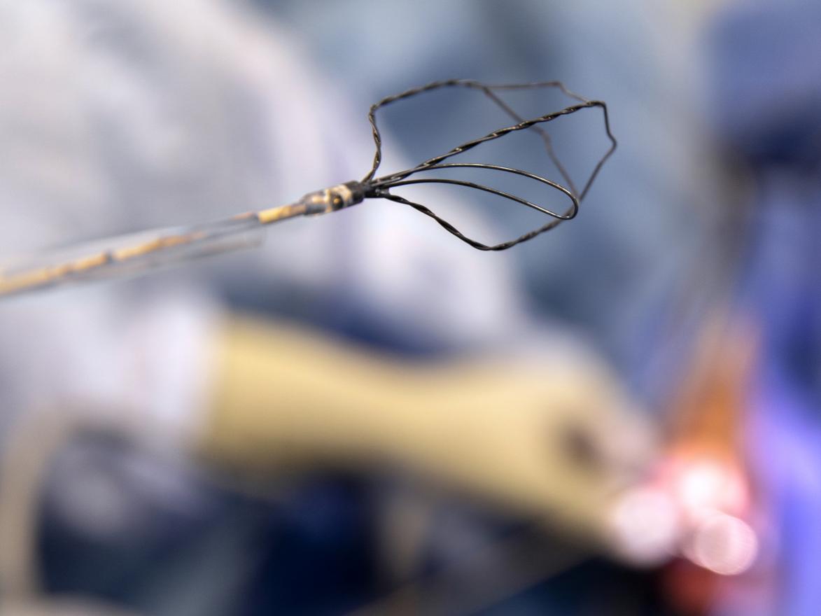 A close-up view of the iTind device, which is made up of approximately five wires that branch off at one point to form an oval shape.