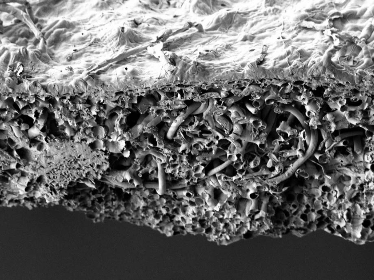 Black and white microscopic image of inside an infected beech leaf