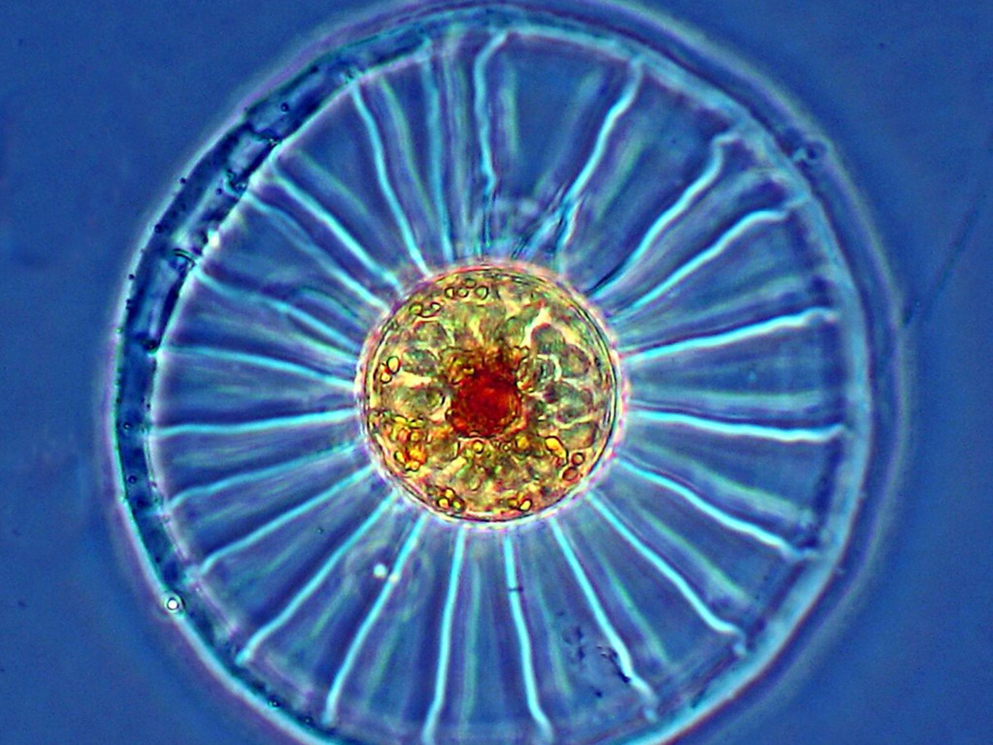 A microscopic image of a wagon wheel diatom
