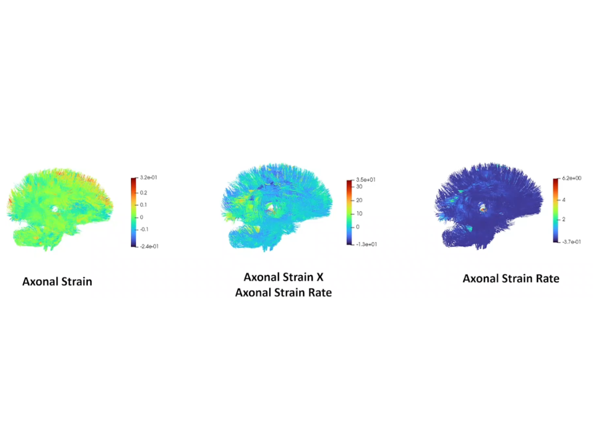 A 3D visualization of an axonal strain within the brain. From left to right, a brain in green, teal and blue show the deformation experienced by axonal fibers due to a football impact.