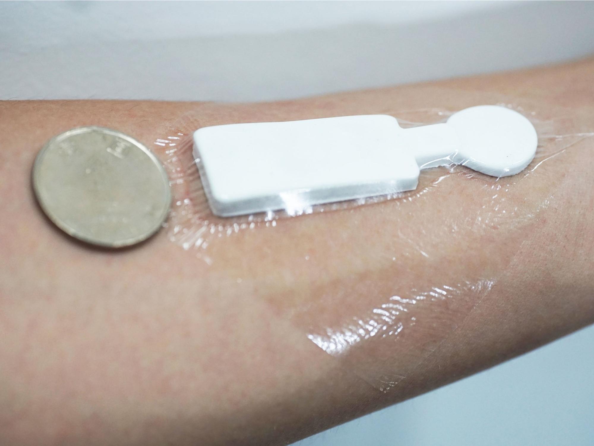 An outstretched arm with the emotion sensor stuck to it