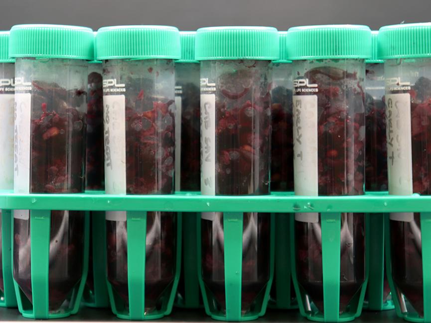 rack of test tubes