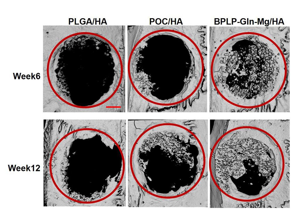 生分解性インプラントで骨折を迅速に再生(Broken bones regrow quickly with help of biodegradable implant)
