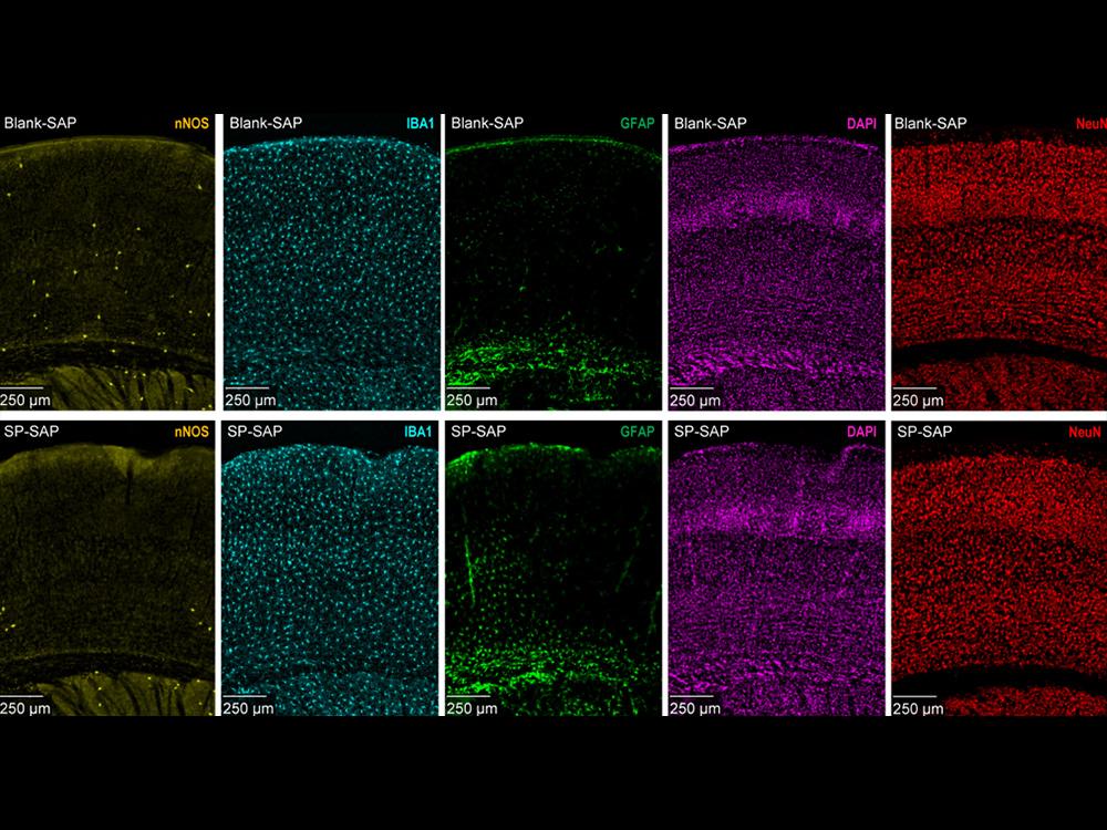 ストレスが脳の血流に与える影響(Stress may lead to altered blood flow in the brain)