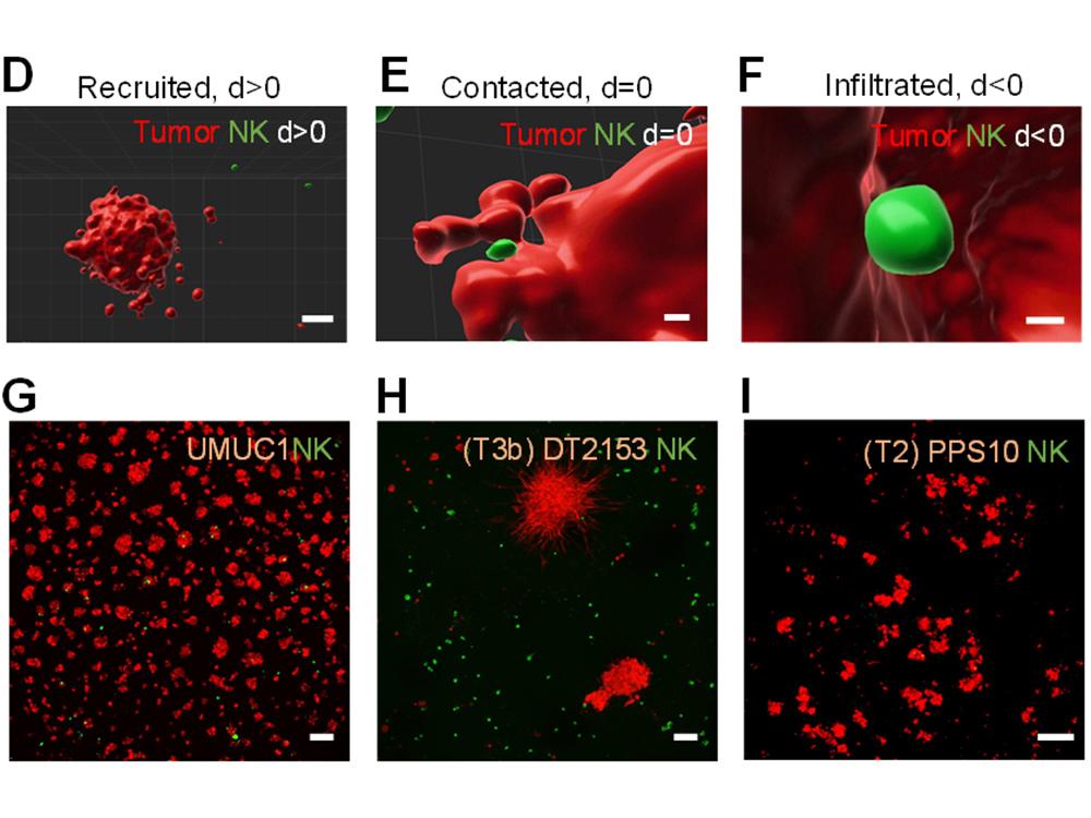 バクテリア由来生成物を用いた個別化がん治療の可能性(Cancer-fighting bacterial product ‘cocktails’ may offer personalized treatment)
