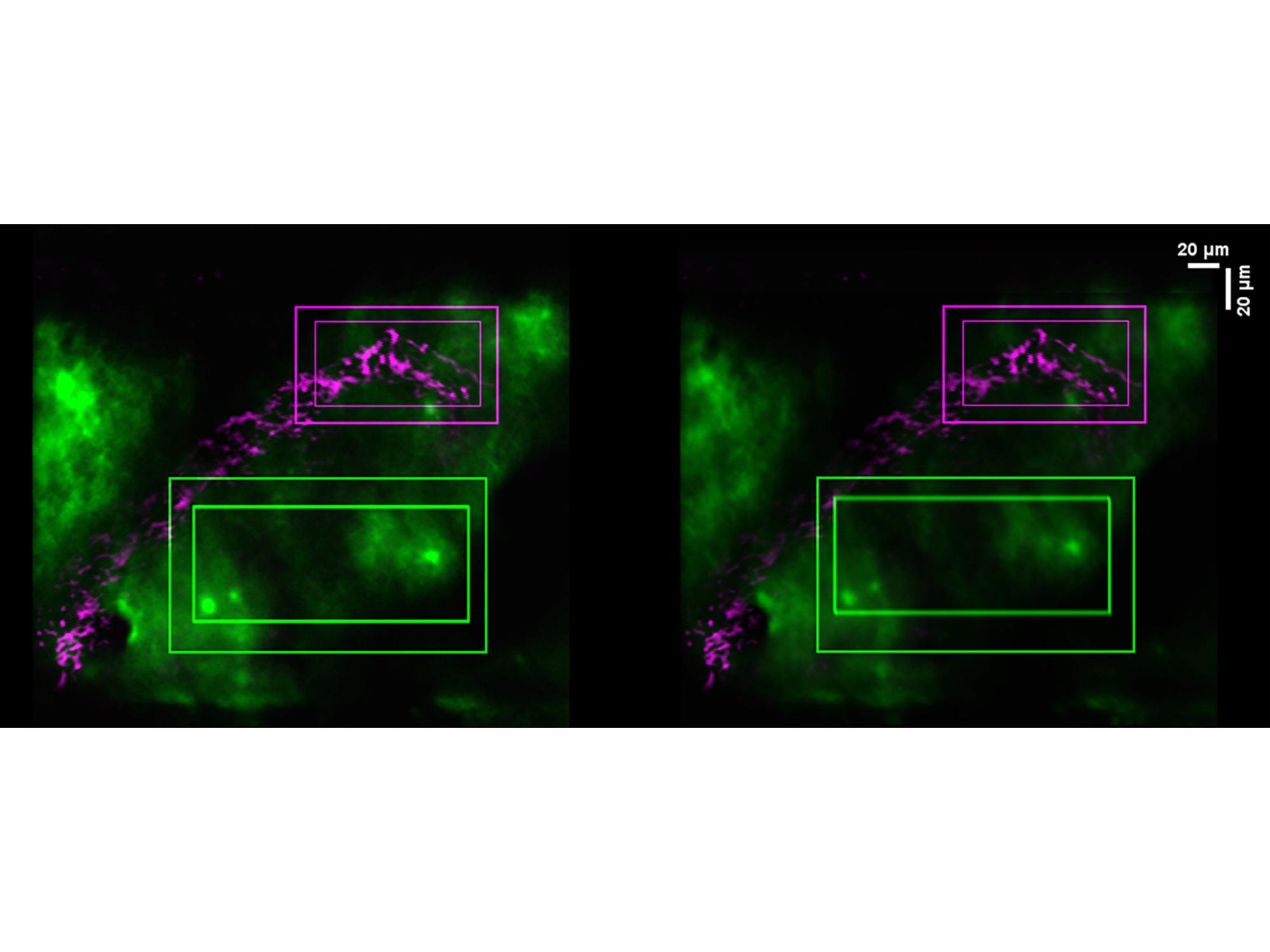 Microscopic image of brain with purple and green lights visible
