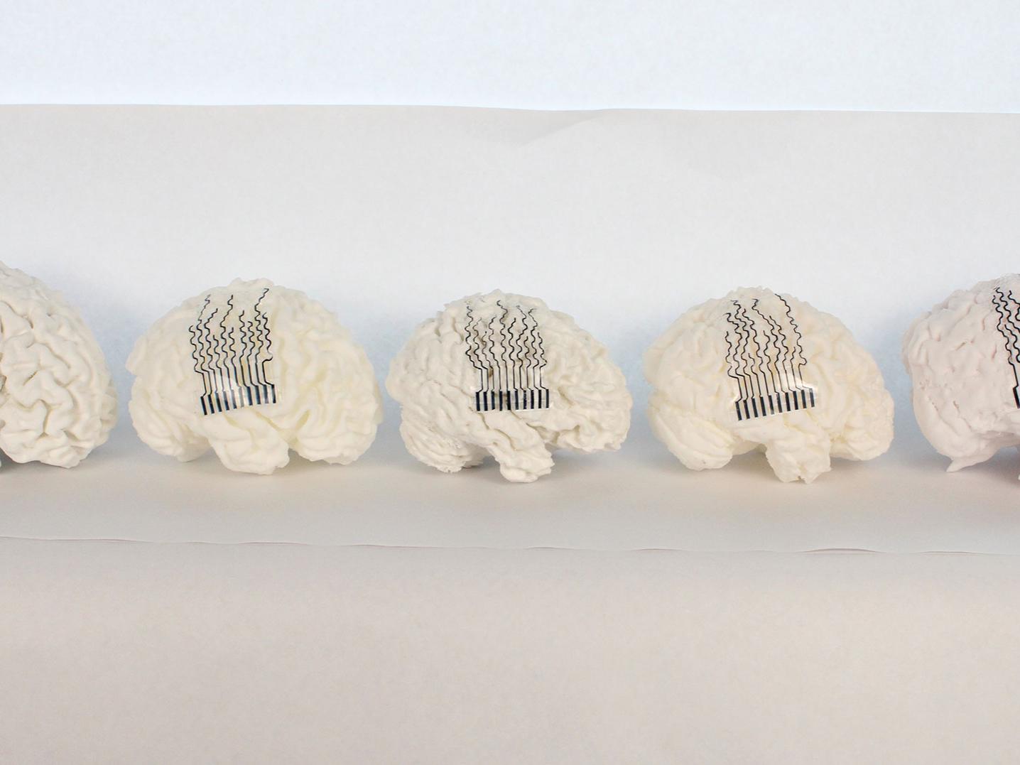 3Dプリント脳センサーによる個別神経モニタリング（3D-printed brain sensors）