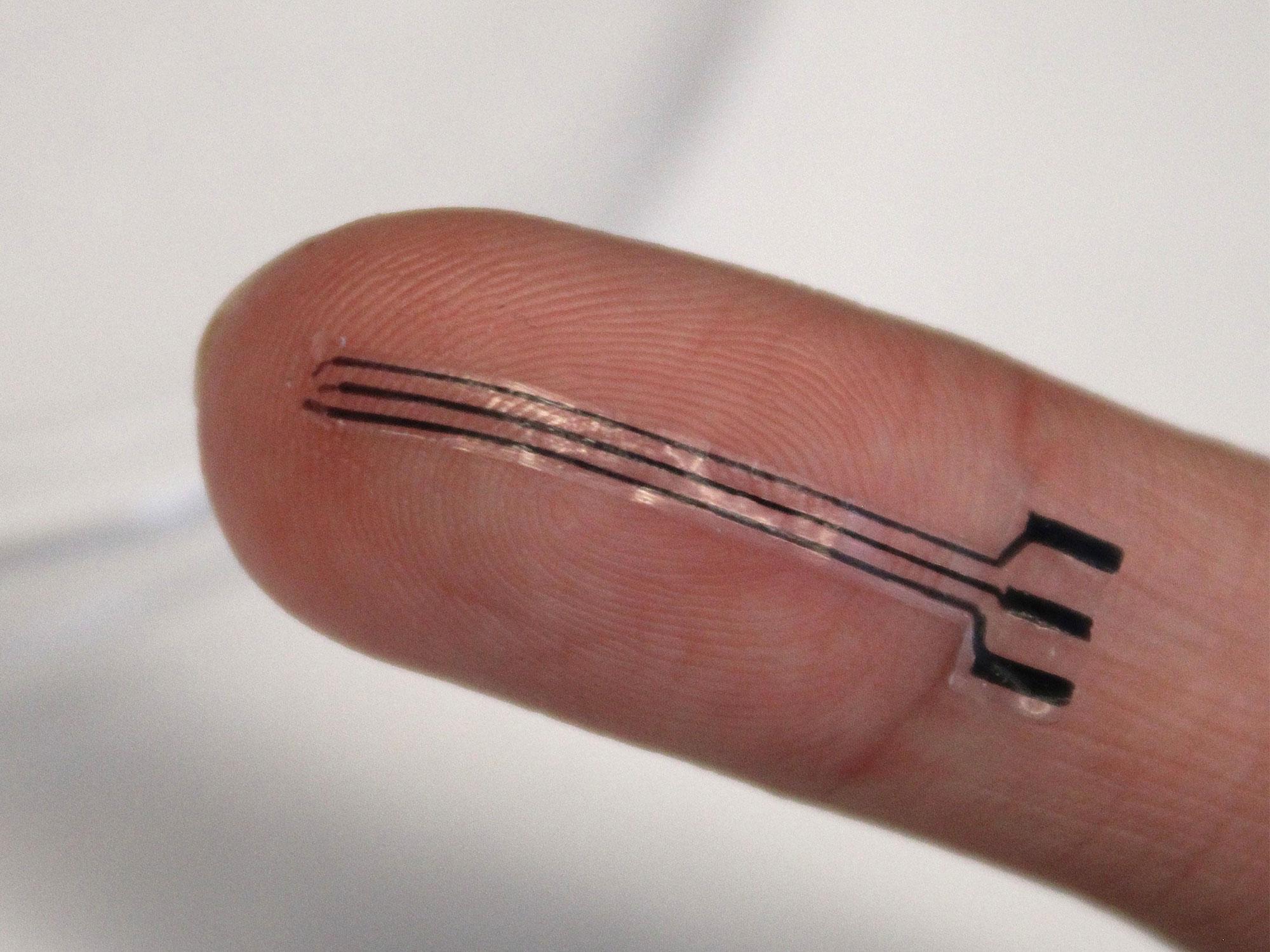 Stretchy implants could stick to arteries to treat high blood pressure