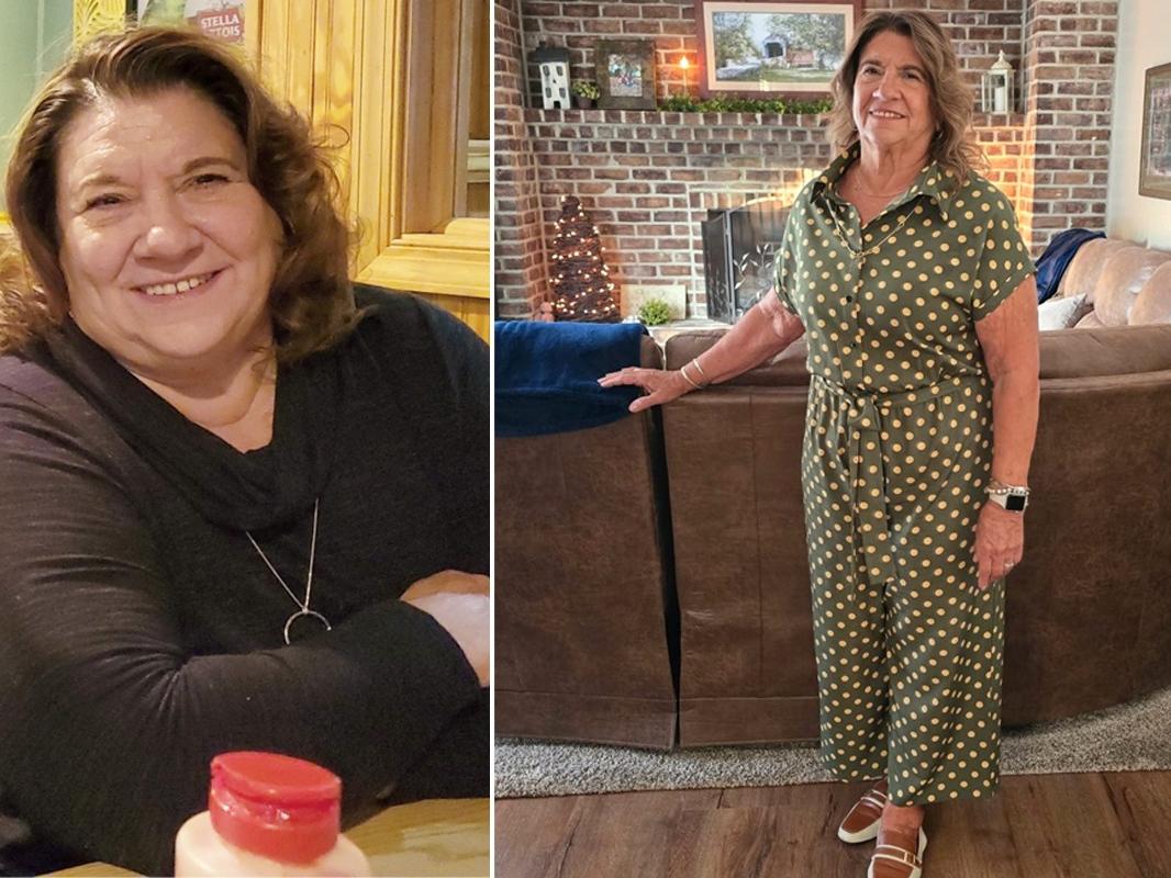 Before-and-after photos of Deborah Dunn following her weight loss.