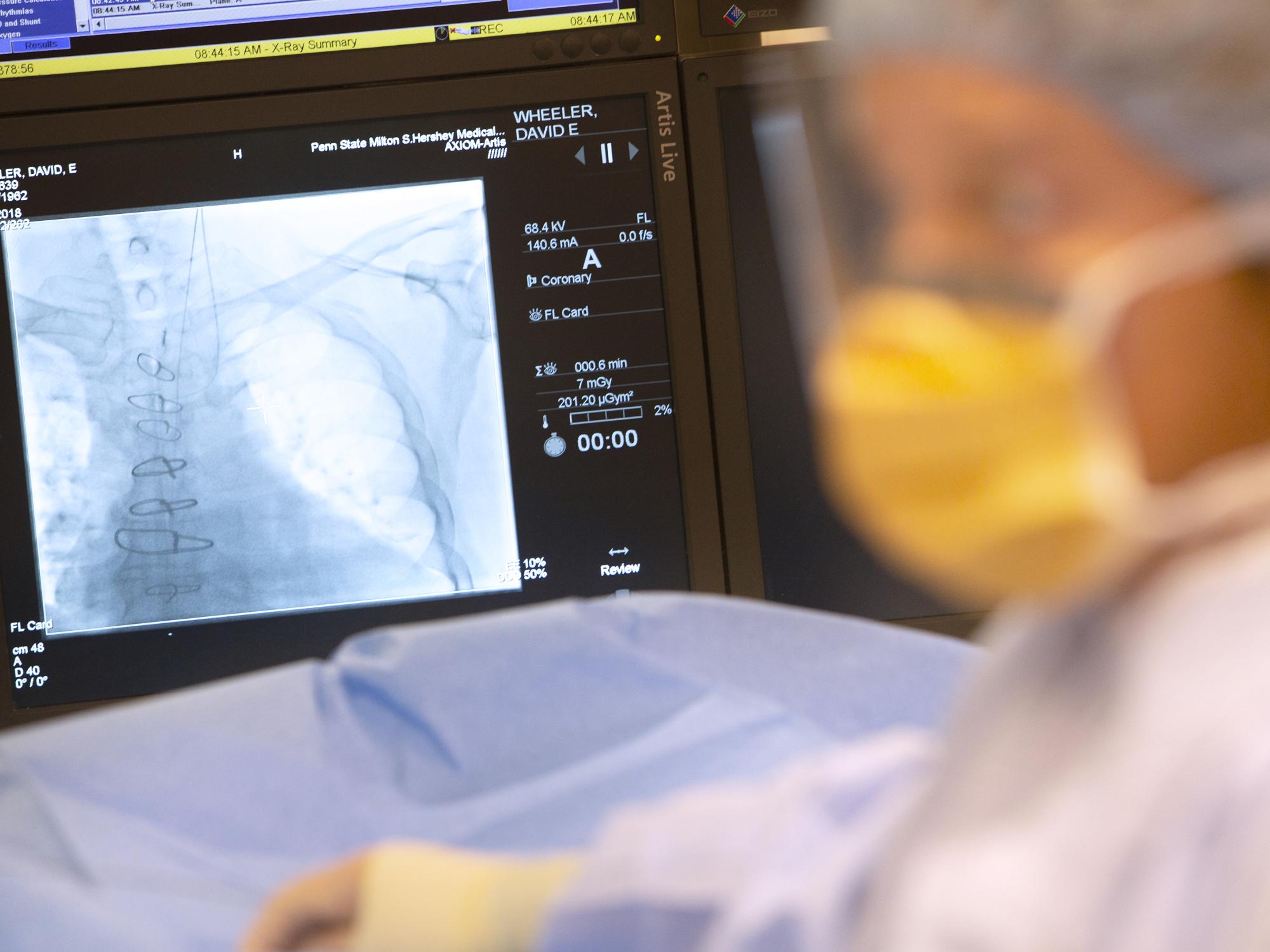 500th heart transplant - Penn State Health Milton S. Hershey Medical Center