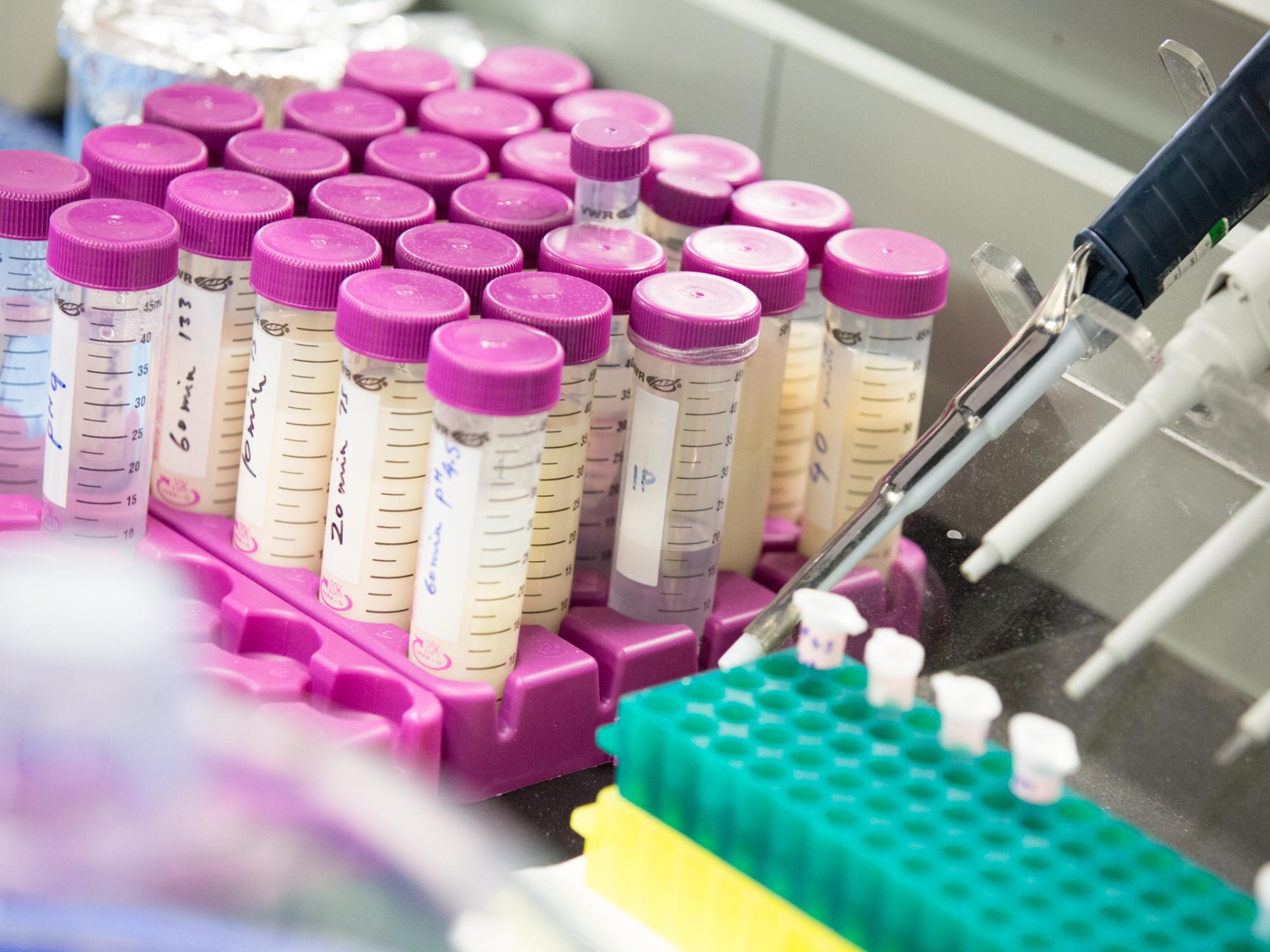 lab vials
