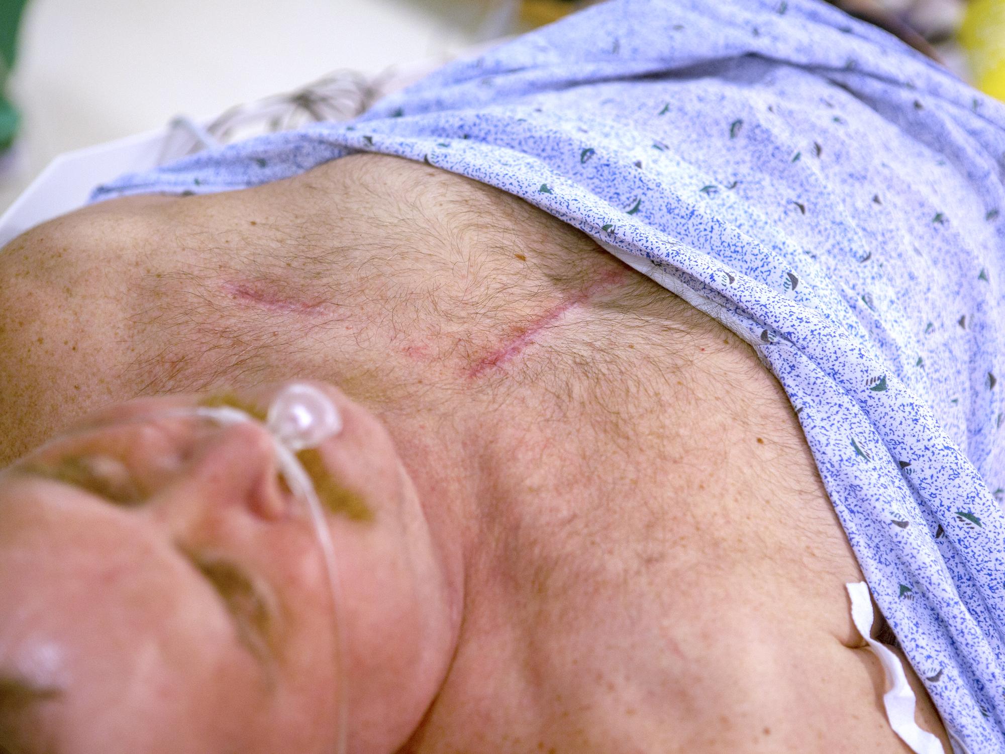 500th heart transplant - Penn State Health Milton S. Hershey Medical Center