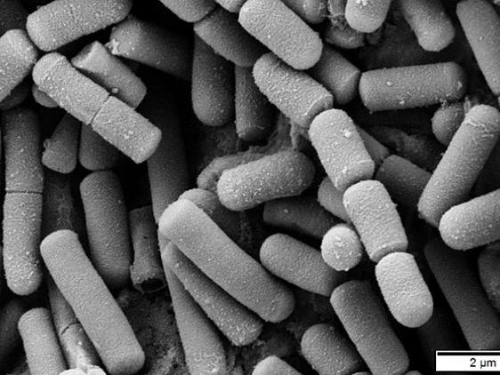 Electron micrograph of Bacillus cereus
