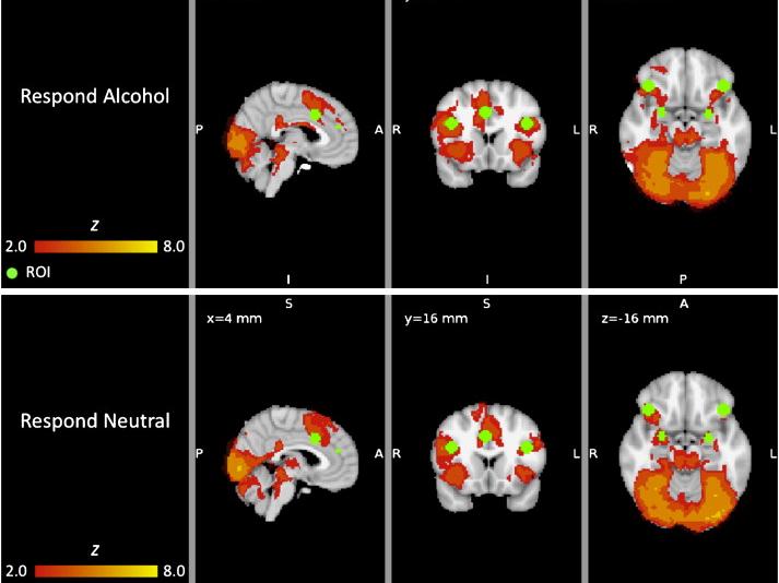 fMRI brain mapping