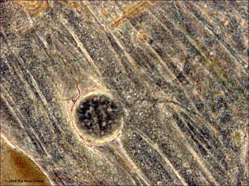 mature oocyst in mosquito gut