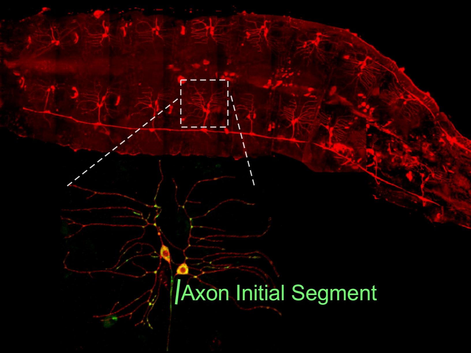 Drosophila larva expressing fluorescent proteins in neurons