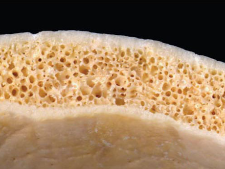 section through skull bone