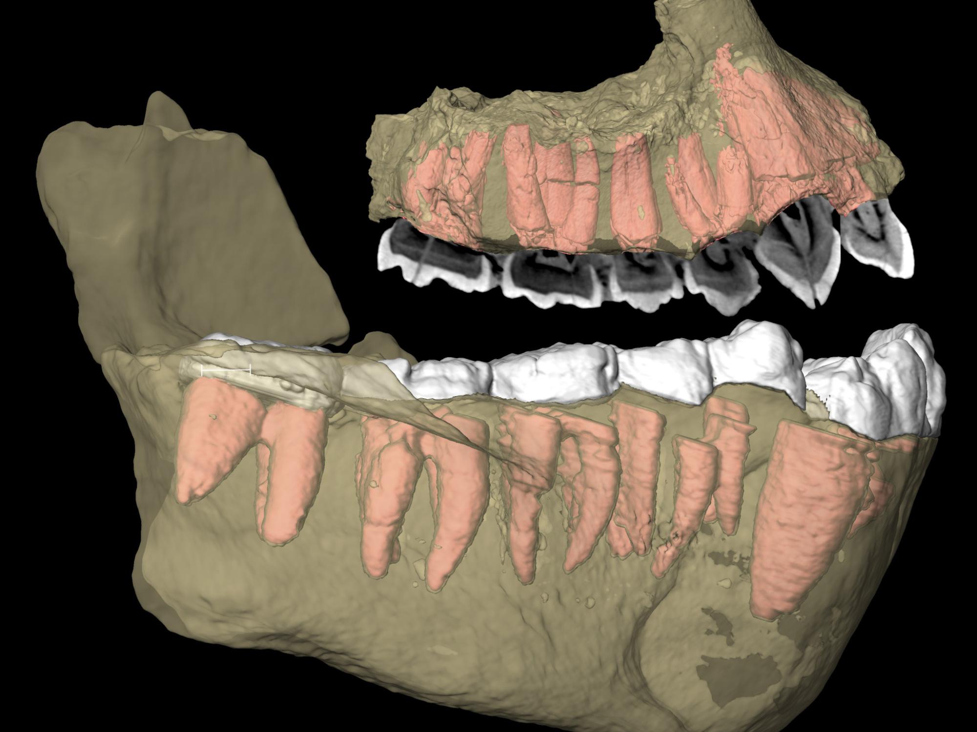 early human teeth and jaw fossil fragments