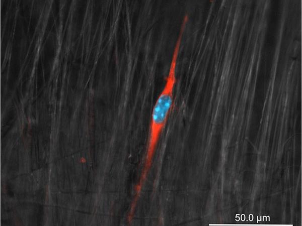 In this scanning electron microscope image, immunostained cells align themselves with polymer nanofibers.