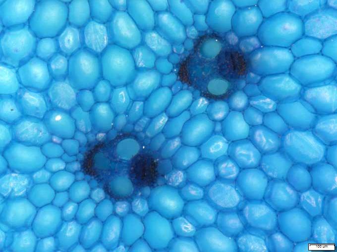 sugar cane cells stained blue