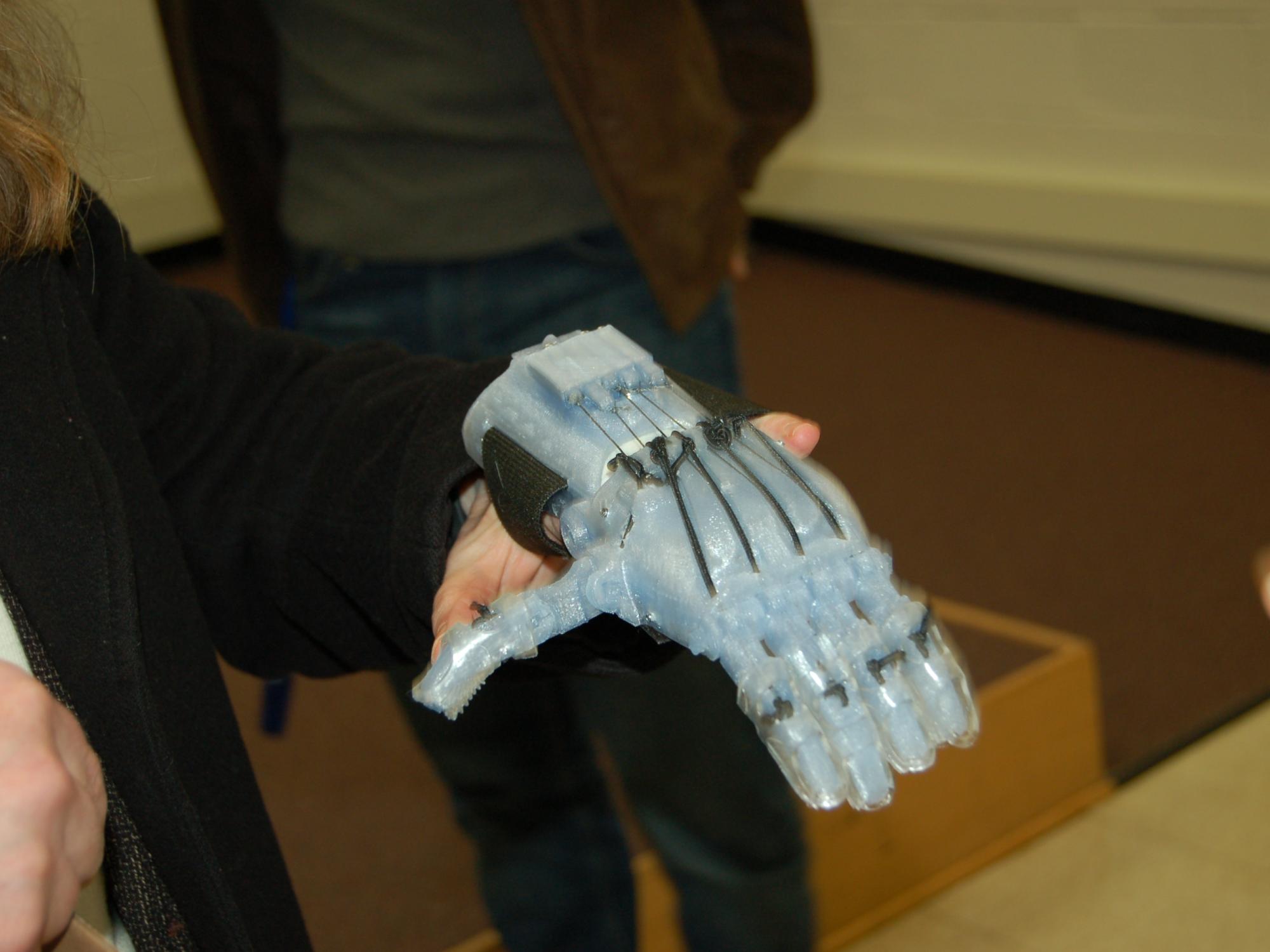 prosthetic hand