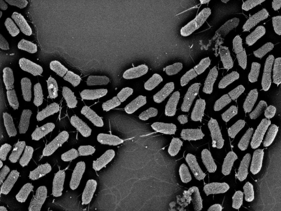 E. coli bacteria