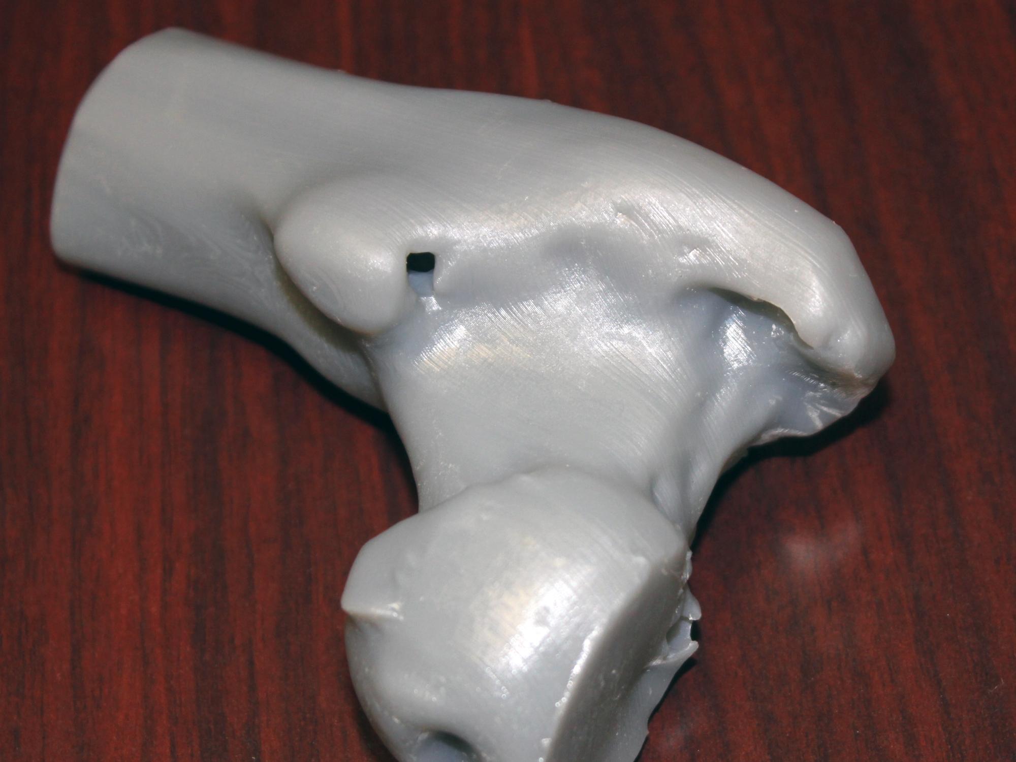 3D prototype of the head of the human femur