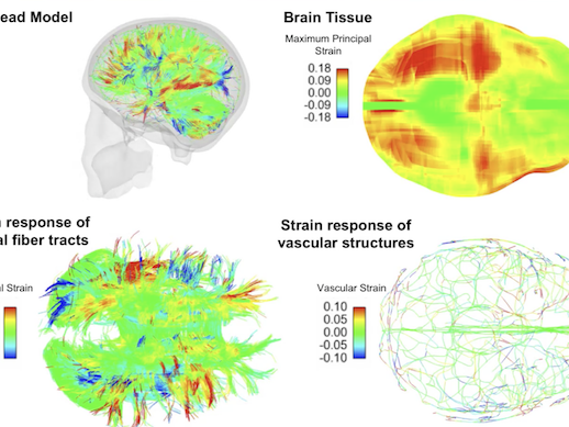 Computational Model of the Human Brain