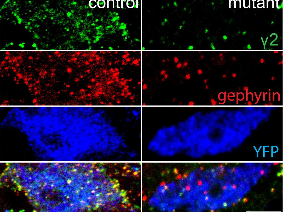 brain thin section GABA-releasing SST+ interneurons (green), others (red)